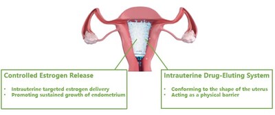 Corina Intrauterine Drug-Eluting System approved in China as a novel treatment for patients with moderate-to-severe intrauterine adhesions (IUA)