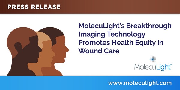 MolecuLight's Breakthrough Imaging Technology Promotes Health Equity in Wound Care