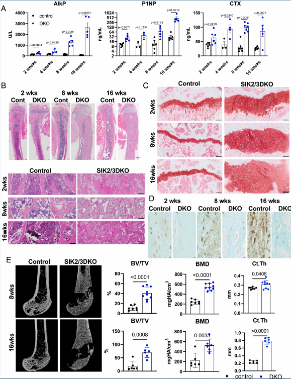 PNAS：新型口服化合物或有望预防并治疗骨质疏松症