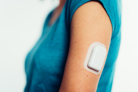 Tandem Diabetes Care to Acquire Insulin Patch Pump Developer, AMF Medical