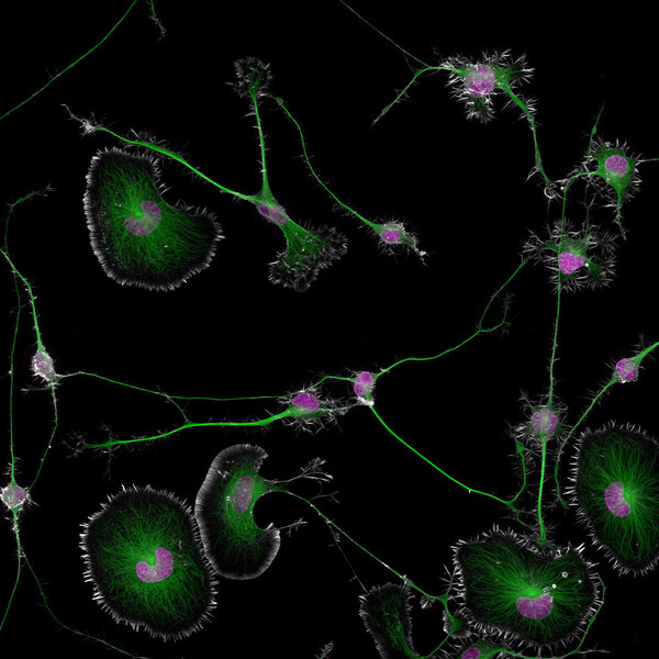 Nikon Small World Competition Celebrates 50 Years with Groundbreaking Image of Brain Tumor Cells