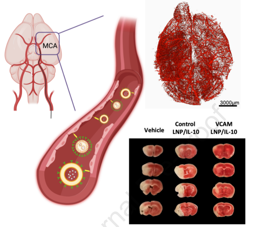 Molecular Therapy: 脂质纳米粒靶向血脑屏障改善急性缺血性卒中