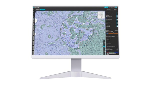 New Study Demonstrates Predictive Value of Lunit SCOPE IO to Predict Outcomes of Immune Checkpoint Inhibitor Therapy Across Diverse Tumors - published in the JITC