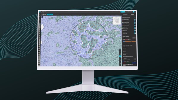 Immune Phenotyping Identified as Promising Predictive Biomarker by Lunit AI in Biliary Tract Cancer - New publication in CCR