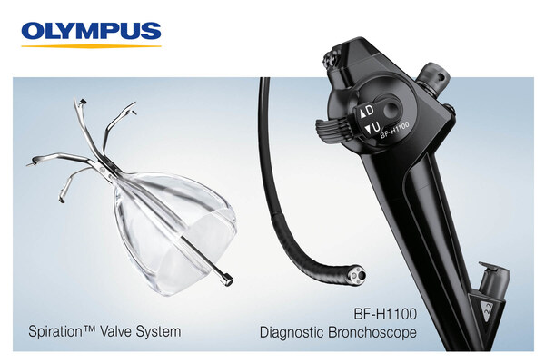 Olympus Highlighting COPD Treatment, AI-Driven Screening Process and EVIS X1 Bronchoscopes at American Thoracic Society Annual Meeting