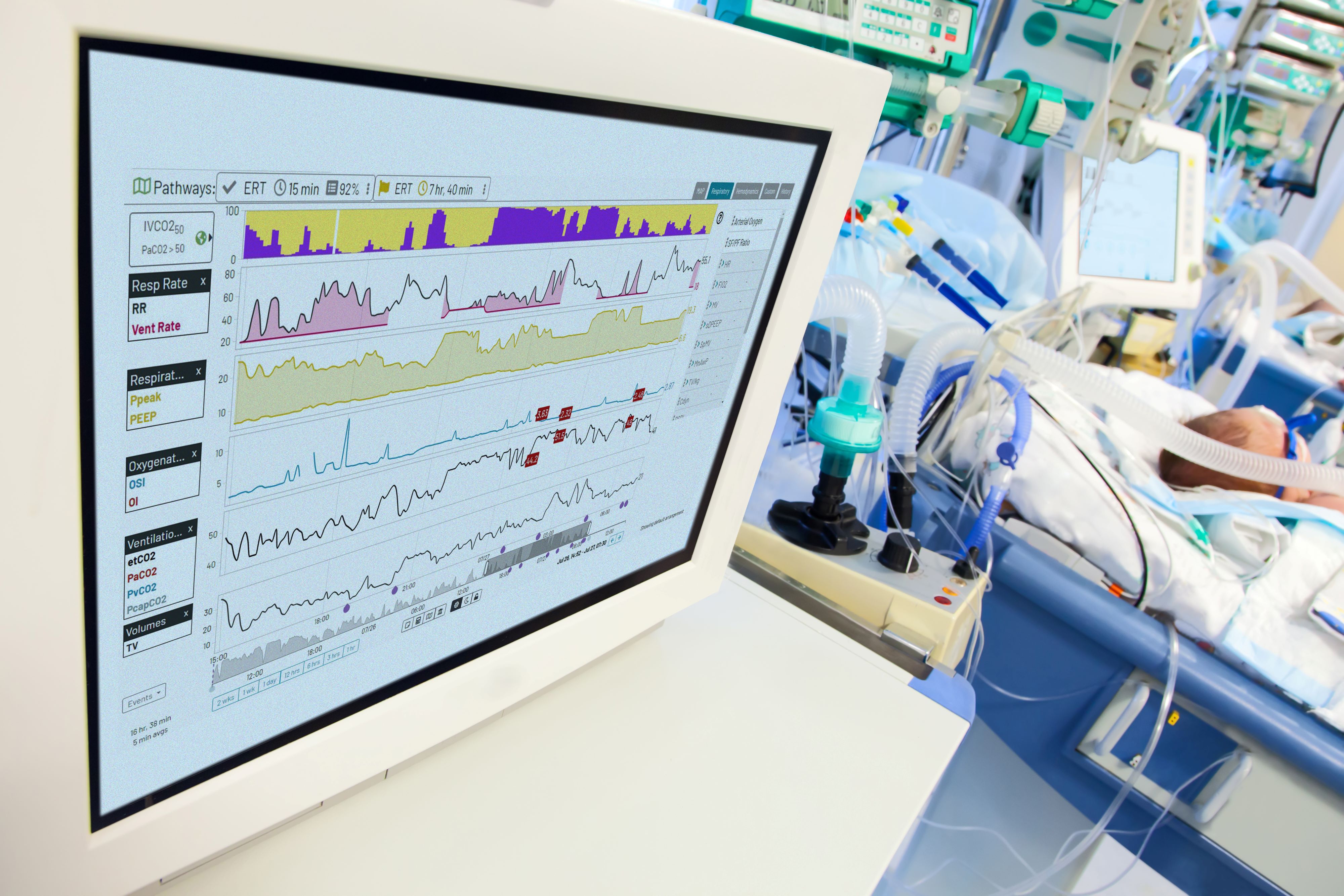 FDA broadens green light for Etiometry's AI algorithm to spot CO2 risk in NICU