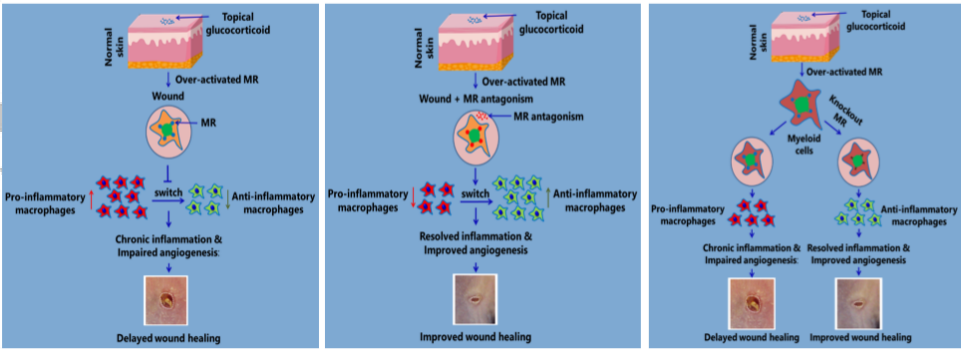 英国药理学: 局部应用盐皮质激素受体拮抗剂与创面愈合