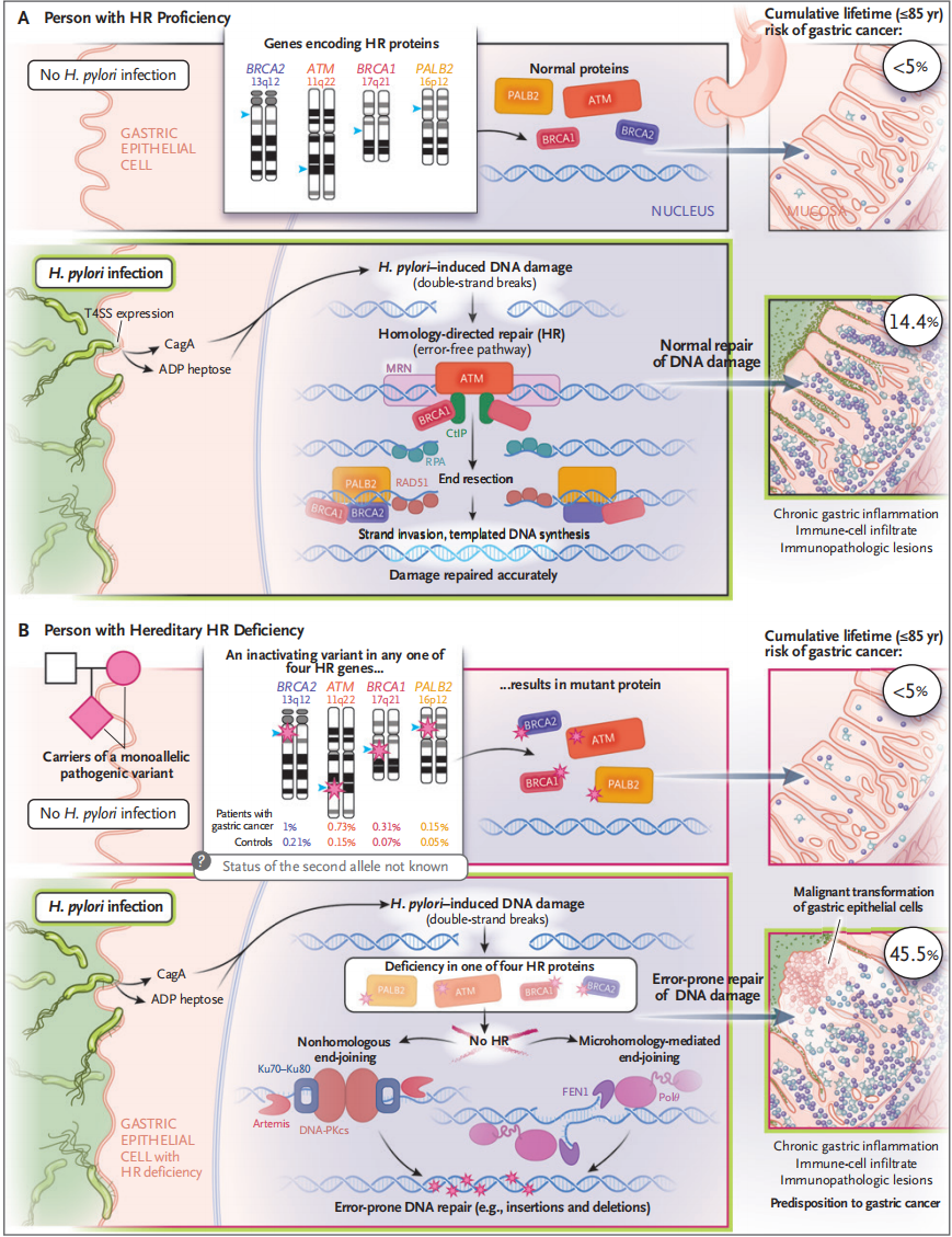 NEJM：幽门螺杆菌感染者有这些基因突变，终生患胃癌风险暴增超2倍！