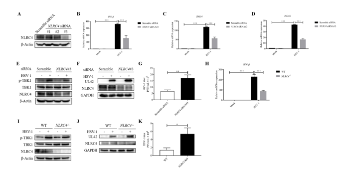 郑春福教授在JMV发表NLRC4调控抗病毒天然免疫cGAS-STING信号通路的文章