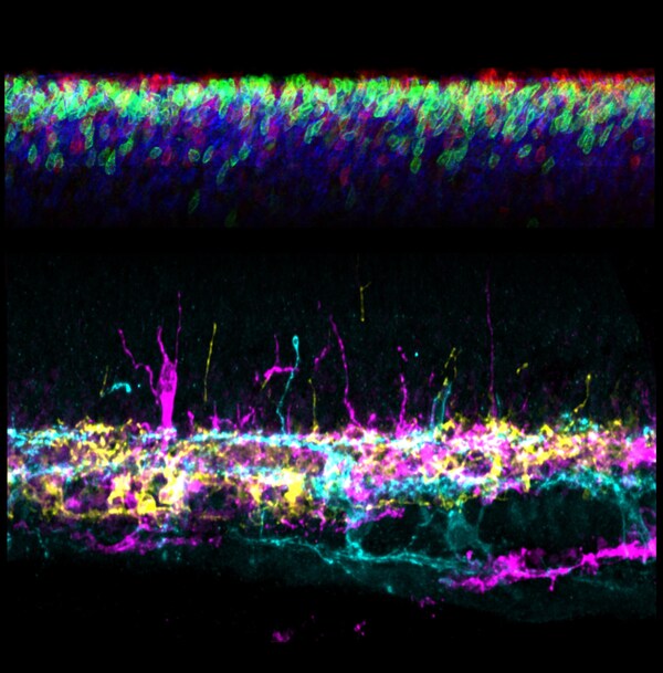 Improved Light Control Might Help Prevent Eye Problems in Premature Infants