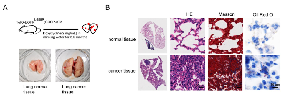 Int. J. Biol. Sci: HIF-1α/SCD1轴可能成为肺癌治疗的新靶点