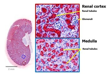 PYC'S FOURTH DRUG CANDIDATE HAS DISEASE-MODIFYING POTENTIAL IN POLYCYSTIC KIDNEY DISEASE