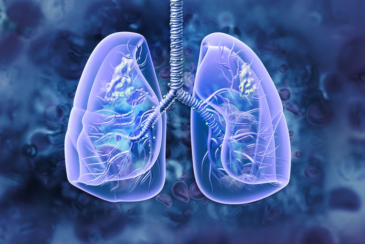 Blueprint tears up plans, dropping 2 lung cancer programs after seeing early clinical data