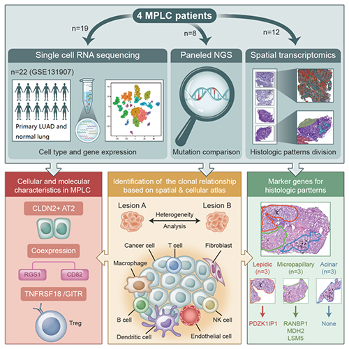 研究揭示多原发肺癌肿瘤微环境细胞组成及空间结构特征