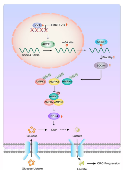 科学家最新揭示了METTL16/SOGA1/PDK4轴可能是治疗结直肠癌的有效靶点