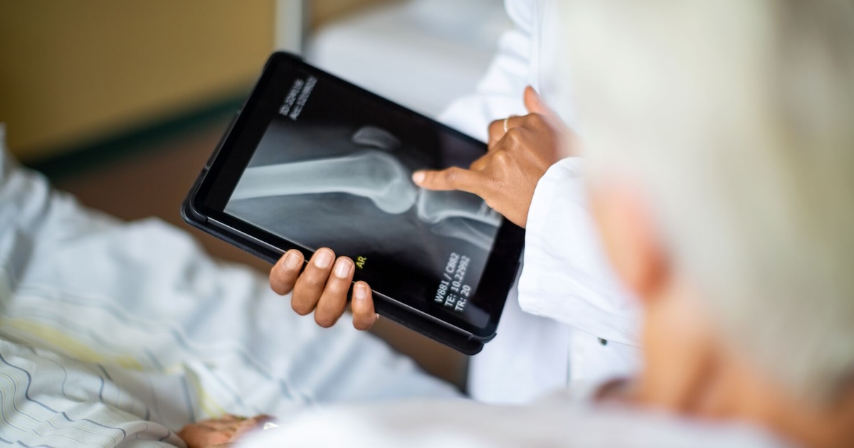 Indonesia OKs osteoporosis screening AI from Taiwan