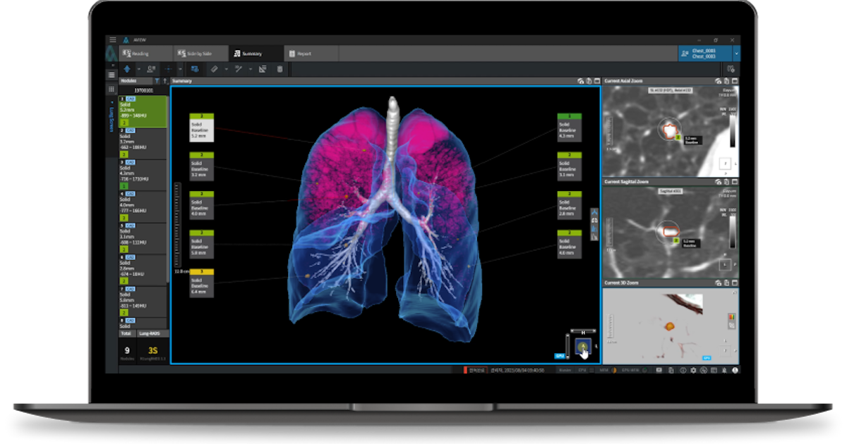 South Korean companies take on the European medical AI market and more partnership briefs