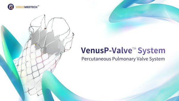 Venus Medtech VenusP-Valve transcatheter pulmonic valve replacement system granted Health Canada approval