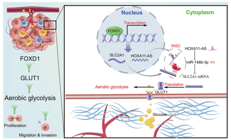 Cell Death and Disease: FOXD1通过调节GLUT1介导的有氧糖酵解促进胰腺癌细胞的增殖、侵袭和转移