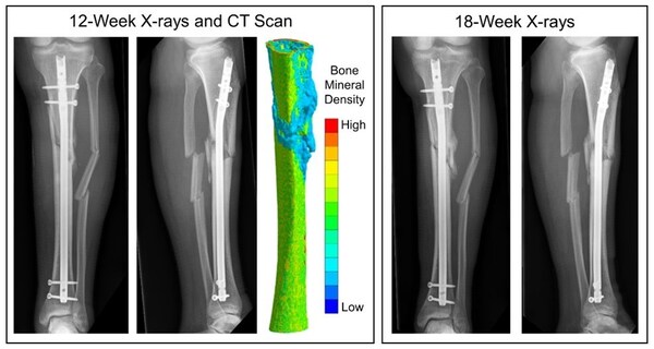 OrthoXel to Present "Micromotion Nailing for Accelerated Fracture Healing" at the Orthopaedic Research Society's (ORS) International Section Fracture Repair (ISFR)18th Biennial Meeting 2024