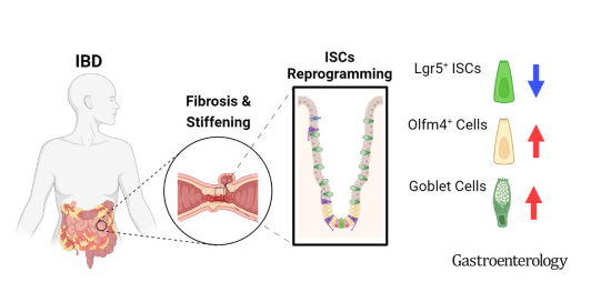 Gastroenterology：科学家揭示肠道纤维化在炎性肠病发生过程中的关键角色