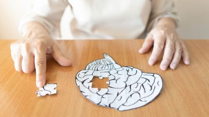 Dementia Action Week 2024: the future of Alzheimer’s diagnostics