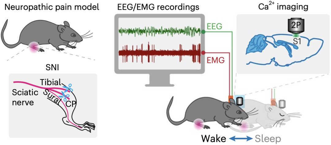 《自然·神经科学》：越睡身上越疼？华人科学家首次揭示睡眠促进慢性疼痛形成与维持的机制