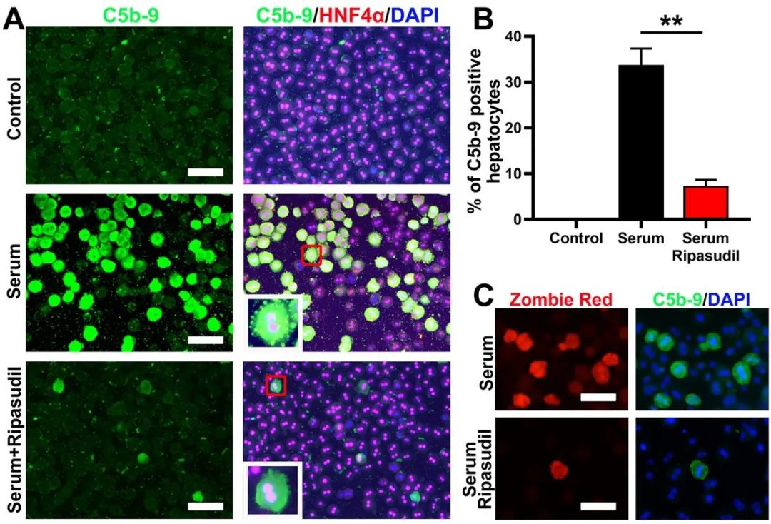 Molecular Therapy：海军军医大学李文林团队揭示ROCK抑制剂增强肝细胞移植的机制