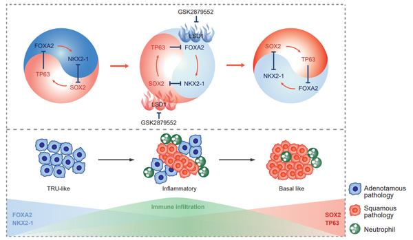 NSR：季红斌/陈洛南/陈海泉合作揭示肺腺鳞癌转分化分子机制及治疗靶点