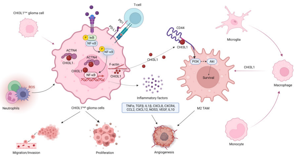 Theranostics: 几丁质酶-3样蛋白-1通过NF-κB信号通路和肿瘤微环境重编程促进胶质瘤进展