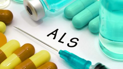 Ionis and Biogen discontinue experimental ALS drug after Phase I/II flop