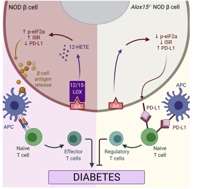 Cell Rep：重点关注胰腺β细胞而并非免疫系统或许有望帮助开发预防1型糖尿病发生的新型疗法