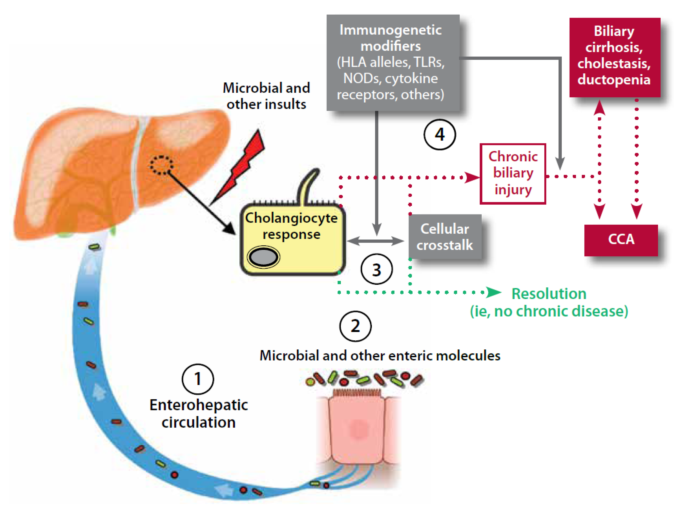 胆汁酸与胆汁淤积性及相关疾病（一）原发性硬化性胆管炎（PSC）